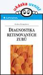 Diagnostika retinovaných zubů