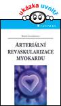 Arteriální revaskularizace myokardu