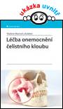 Léčba onemocnění čelistního kloubu
