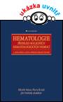 Hematologie - Přehled maligních hematologických nemocí