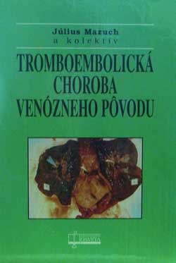 Tromboembolická choroba venózneho pôvodu